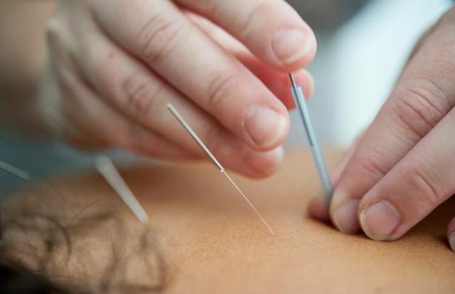Đau chân dữ dội sau khi châm cứu, người phụ nữ sốc nặng khi biết sự thật đáng sợ - Ảnh 1.