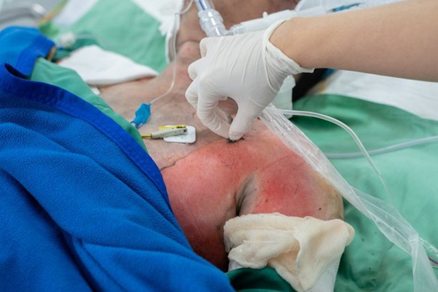 Tình trạng sức khỏe các nạn nhân vụ cháy nhà khiến 2 người tử vong - Ảnh 1.