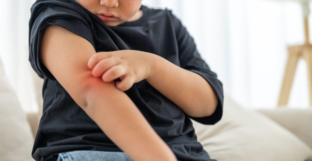 Đầu năm học mới, cha mẹ nhớ làm việc này để phòng viêm não Nhật Bản cho con - Ảnh 1.