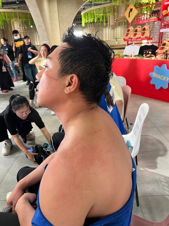 Lộ ảnh Trấn Thành bị bầm dập, tả tơi khiến fan xót xa - Ảnh 5.