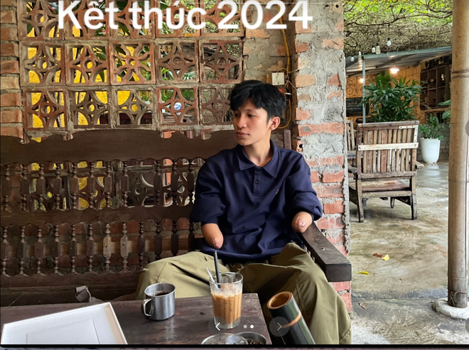 Ch&agrave;ng trai genZ mồ c&ocirc;i, gặp biến cố mất 2 tay, truyền th&ocirc;ng điệp t&iacute;ch cực qua từng video- Ảnh 4.