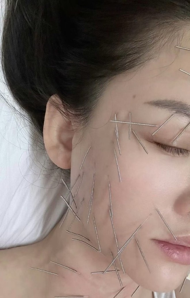 "Nữ hoàng phim thần tượng" gây sốt khi cắm hàng trăm chiếc kim khắp cơ thể- Ảnh 2. "Nữ hoàng phim thần tượng" gây sốt khi cắm hàng trăm chiếc kim khắp cơ thể- Ảnh 2.