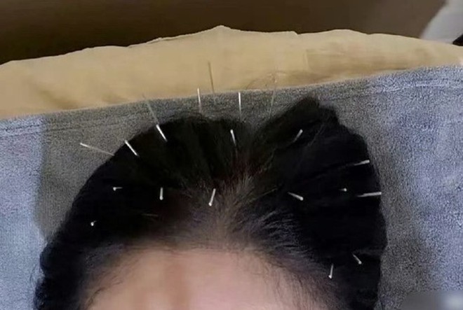 "Nữ hoàng phim thần tượng" gây sốt khi cắm hàng trăm chiếc kim khắp cơ thể- Ảnh 3. "Nữ hoàng phim thần tượng" gây sốt khi cắm hàng trăm chiếc kim khắp cơ thể- Ảnh 3.