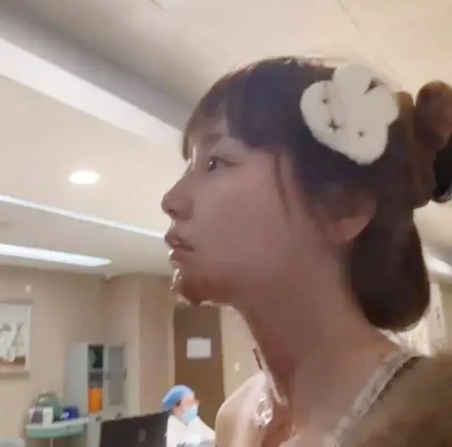 Nữ diễn vi&ecirc;n 27 tuổi bị bỏng nặng v&igrave; bắt trend "b&aacute;nh sinh nhật phun lửa"- Ảnh 3.