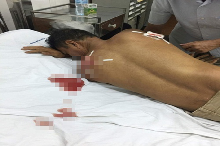 Kẻ đâm hàng xóm nguy kịch được công an... cho về nhà