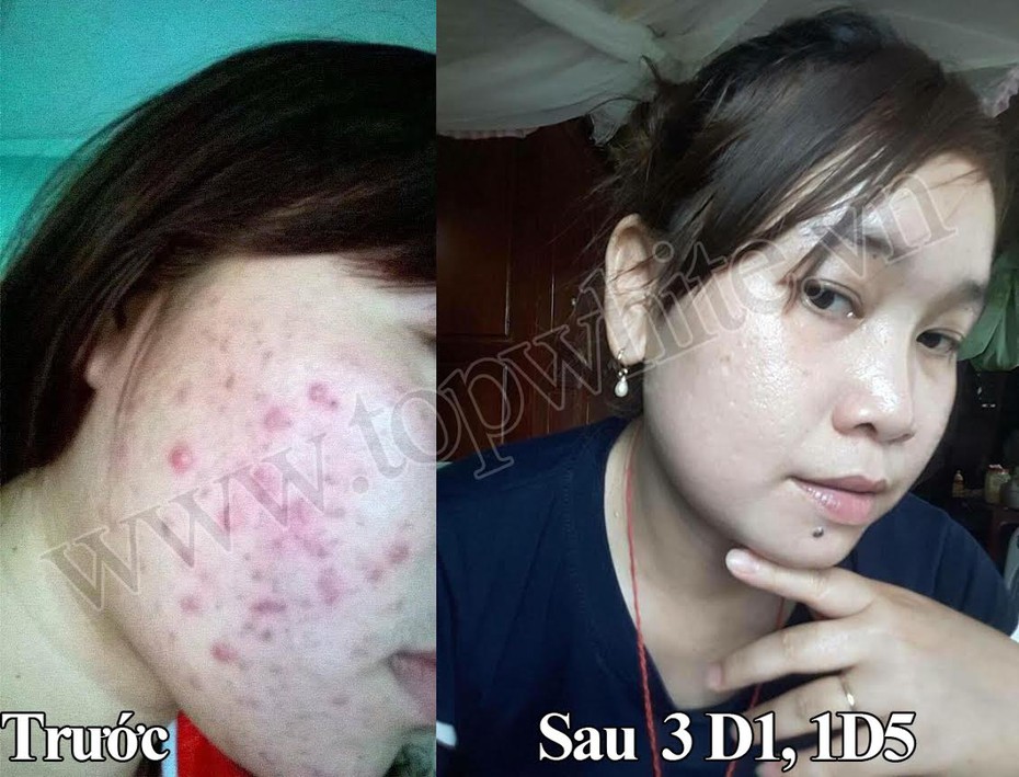 Kết quả kiểm nghiệm của Sở Y Tế Tp. HCM: Sản phẩm Top White đạt TCCL