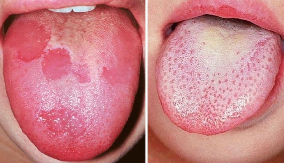 10 dấu hiệu cảnh báo bạn có thể đã mắc ung thư giai đoạn đầu