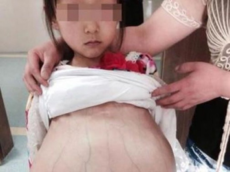 Thông tin bất ngờ về cô gái mang thai ở Trung Quốc gây bão mạng