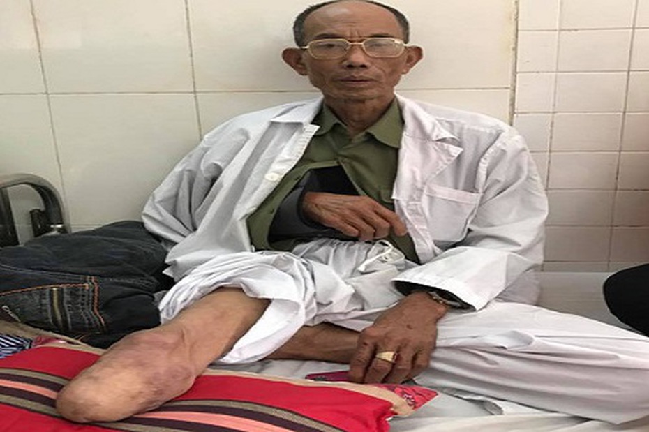 Đề nghị truy tố các đối tượng hành hung người thương binh cụt chân
