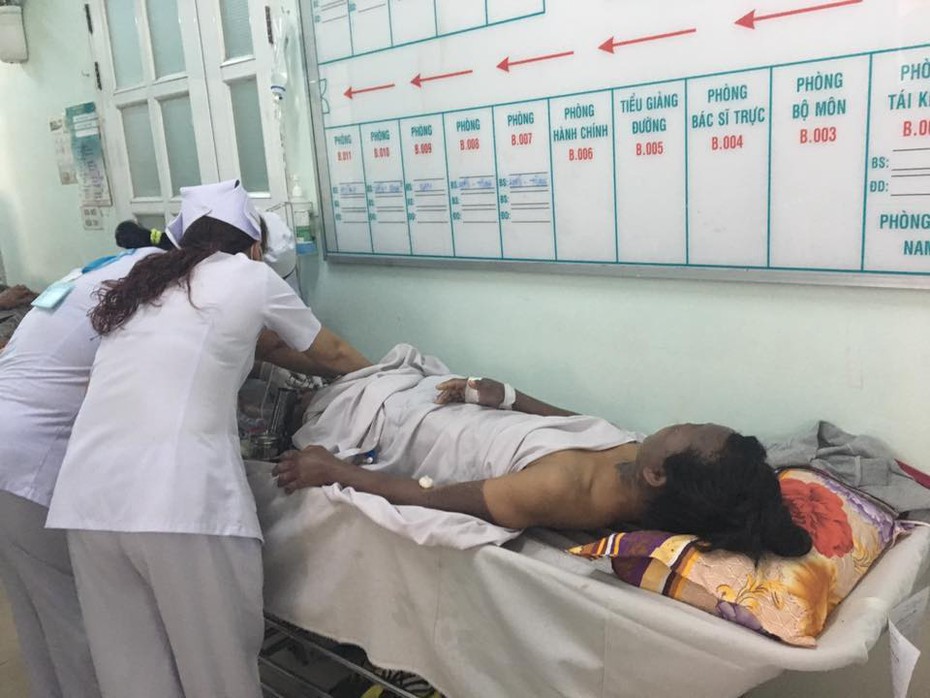 Ba nhân viên quán bún bò bị bỏng nặng do rò khí gas