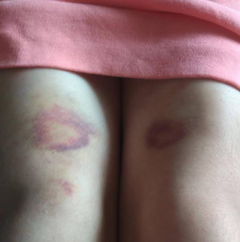 Xác minh vụ chủ quán gội đầu đánh khách chấn thương sọ não