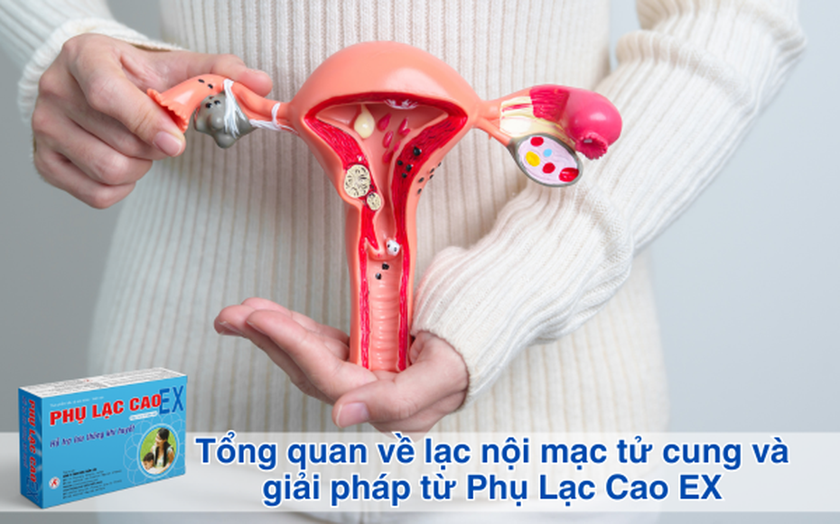 Tổng quan về lạc nội mạc tử cung và giải pháp từ Phụ Lạc Cao EX