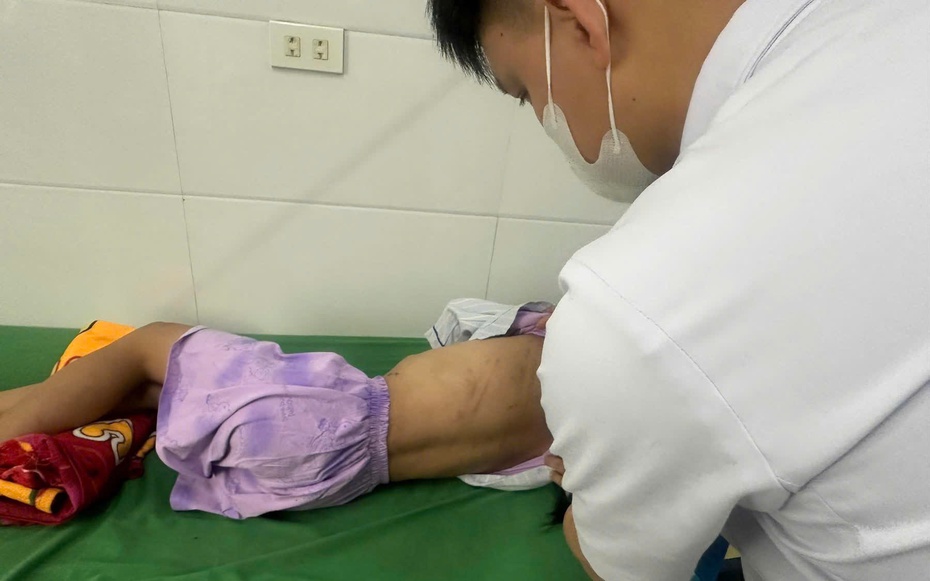 Vụ bé gái lớp 5 bị cha dượng bạo hành: “Bố uống rượu vào thường hay đánh con”