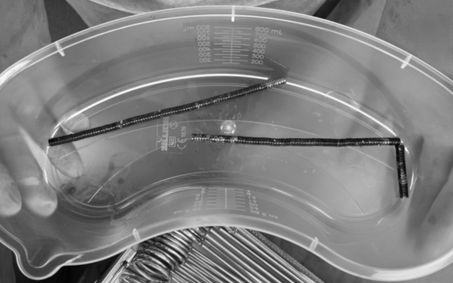 Bé trai 13 tuổi đau bụng dữ dội, bác sĩ phát hiện bí mật "đáng sợ" bên trong