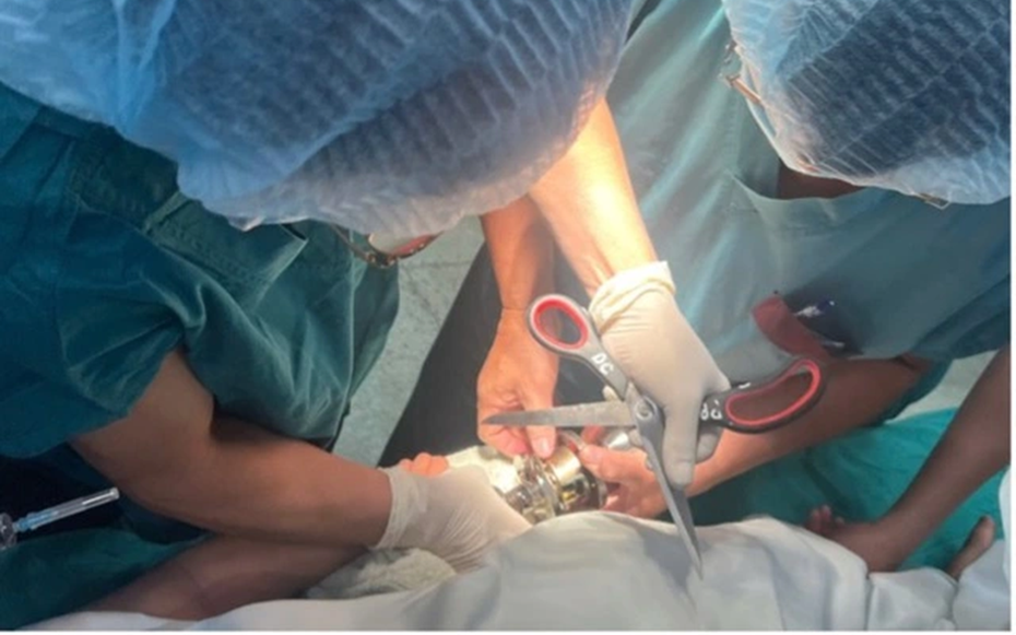 Bé trai 5 tuổi "ôm" ổ khóa nhập viện cấp cứu, bác sĩ phát cảnh báo khẩn