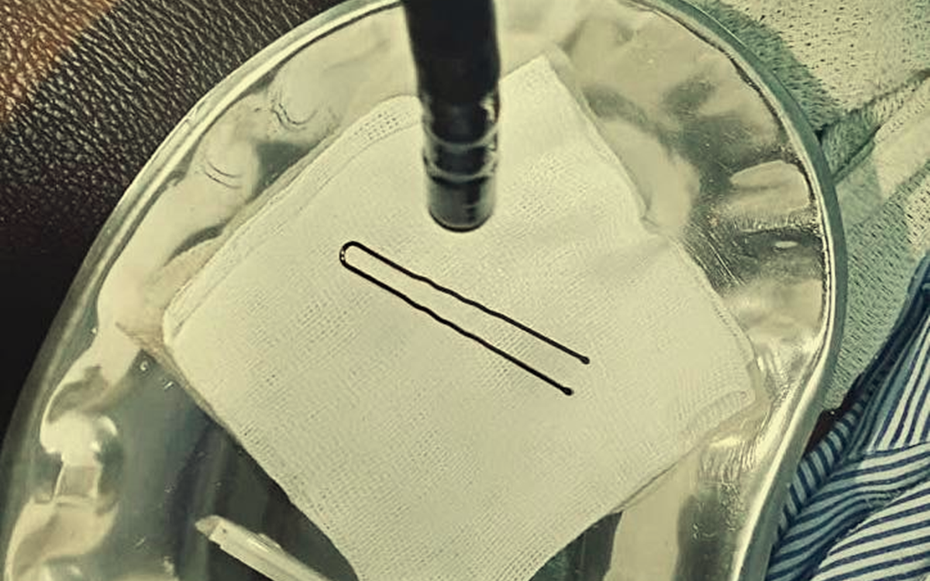 Bé gái 4 tuổi đột ngột khóc thét, vào viện bác sĩ gắp ra thứ "đáng sợ" bên trong