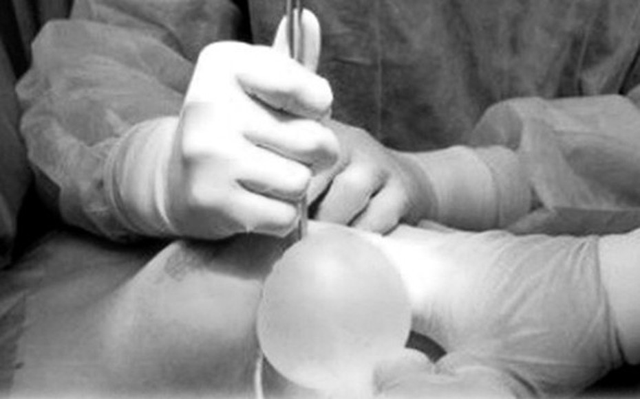 Người phụ nữ 30 tuổi bị hoại tử ngực vì tiêm chất làm đầy