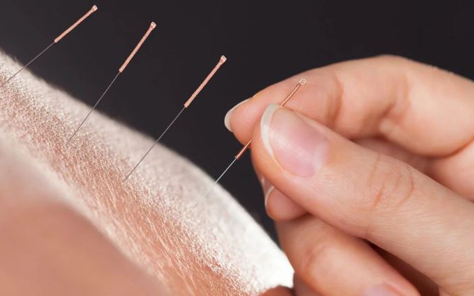 Người đàn ông 47 tuổi phải cắt một bên chân sau khi đi châm cứu