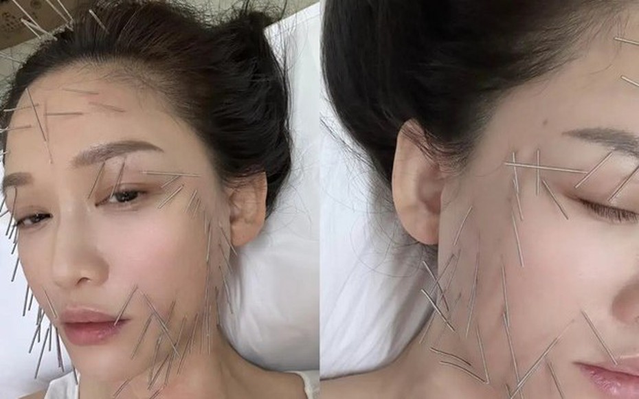 "Nữ hoàng phim thần tượng" gây sốt khi cắm hàng trăm chiếc kim khắp cơ thể