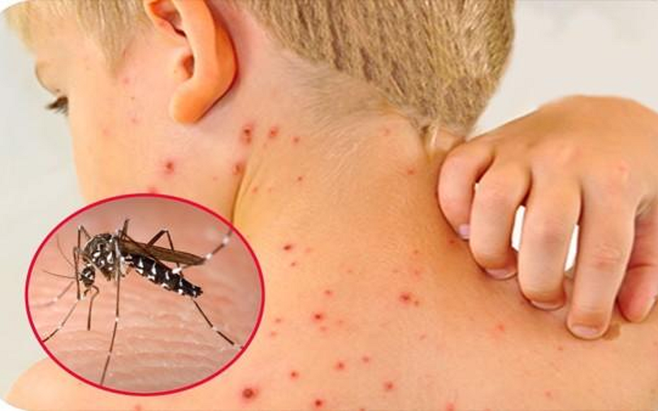 Sốt xuất huyết tăng “nóng” giữa mùa mưa, WHO khuyến nghị tiêm vắc-xin