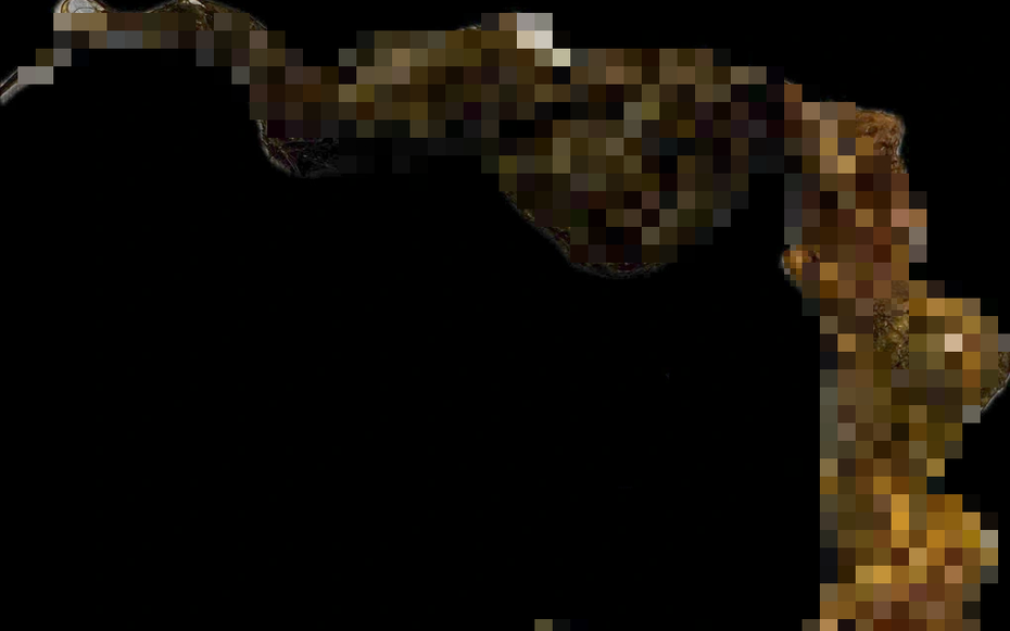 Bé gái 9 tuổi có thói quen lạ đời, bác sĩ gắp ra thứ "đáng sợ" trong bụng