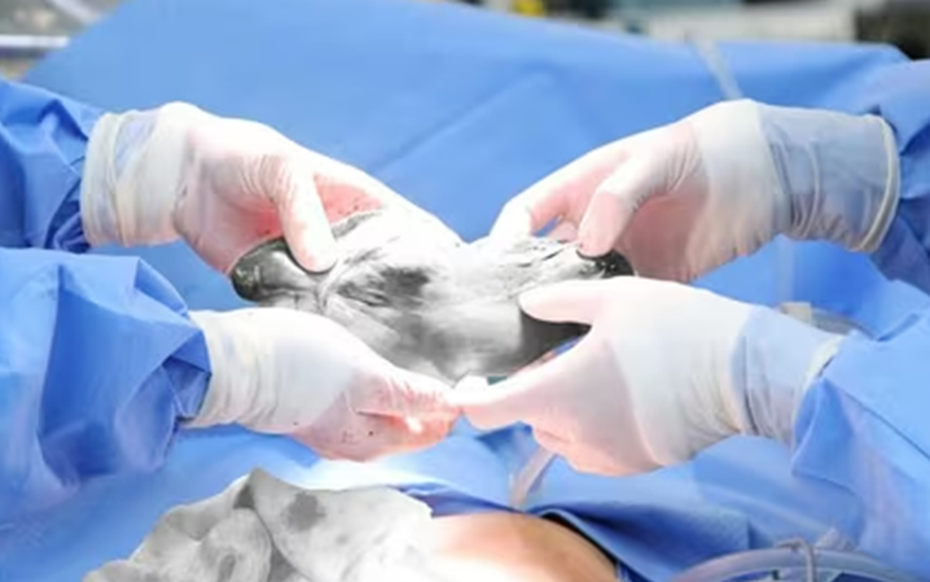 Đau bụng kéo dài, người phụ nữ đi khám phát hiện bí mật đáng sợ