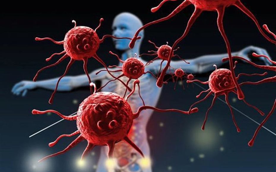 Ăn cơm có cảm giác nuốt vướng, người đàn ông sốc khi phát hiện 3 bệnh ung thư cùng lúc