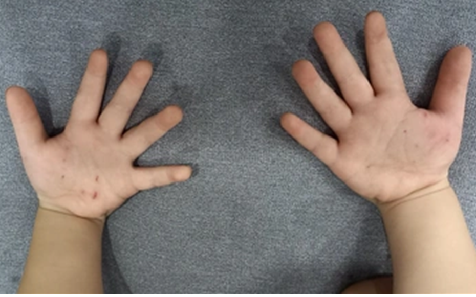 Con đang chơi bỗng khóc ngặt nghẽo, mẹ sững sờ khi phát hiện “bí mật”