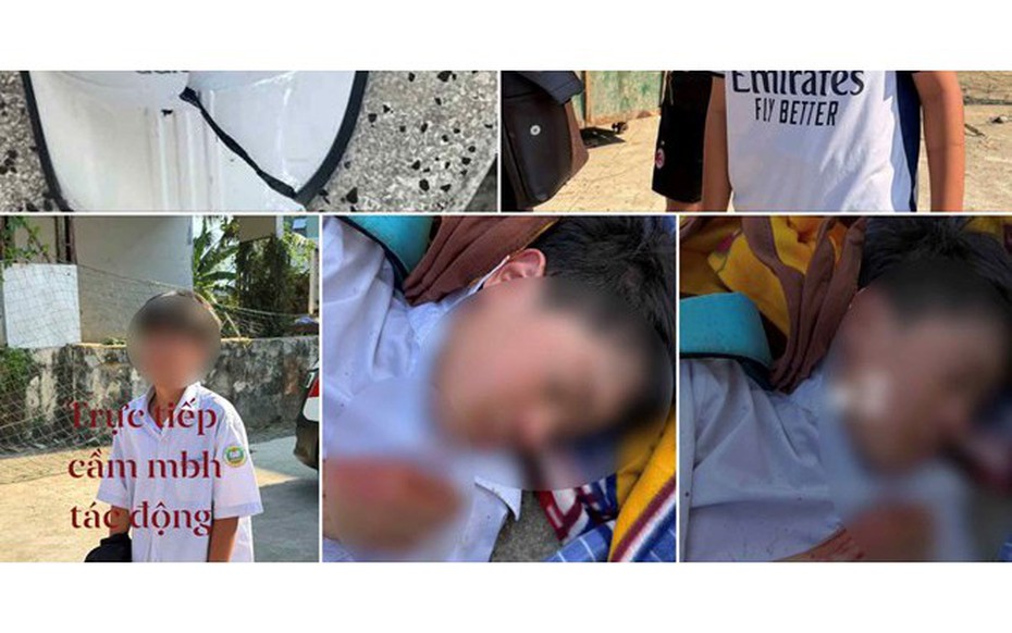 Nam sinh lớp 6 bị đánh hội đồng chỉ vì không cho mượn xe đạp