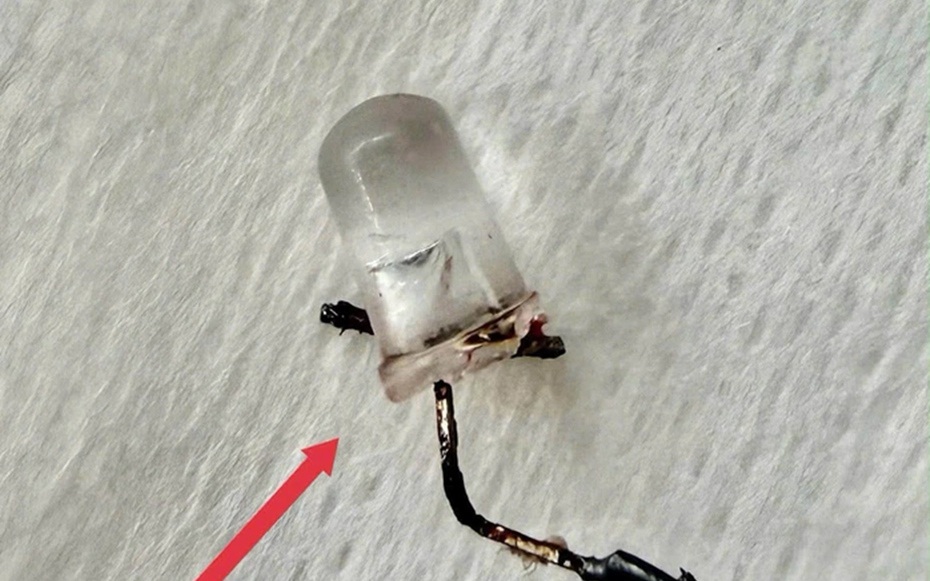 Bé 9 tháng tuổi ho nhiều ngày, bố mẹ "sốc" khi bác sĩ gắp ra đèn LED nằm trong phế quản
