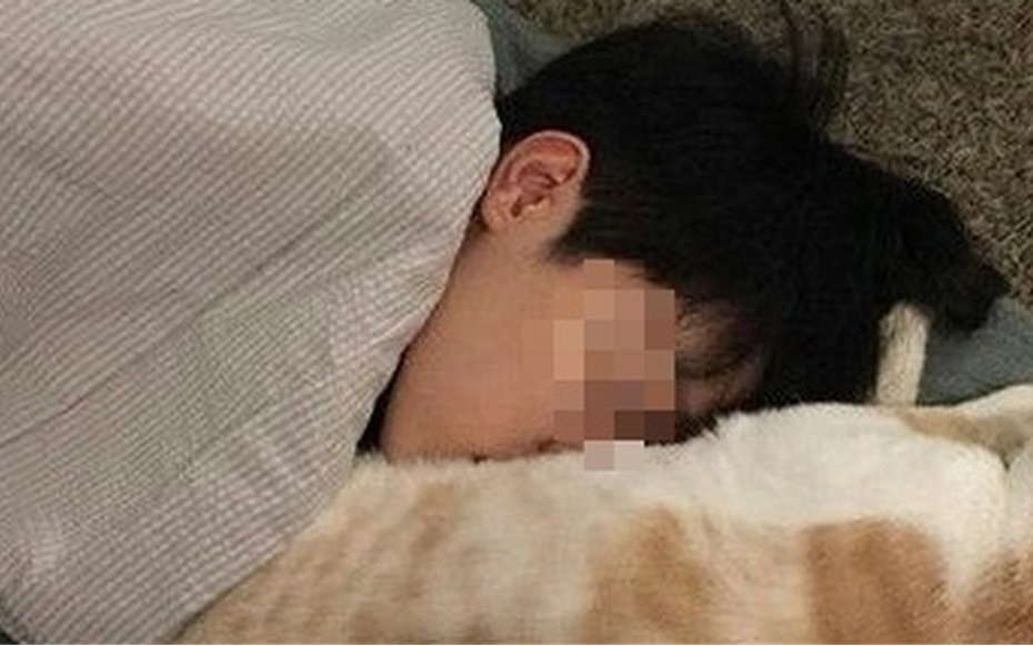 Ôm mèo mà không rửa tay, cậu bé 14 tuổi "sốc" khi biết mình "gần như mù lòa"