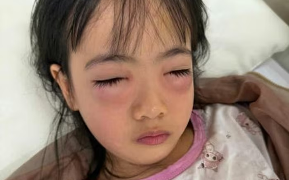 Chơi bong bóng xà phòng, bé 5 tuổi nguy kịch phải cấp cứu, sự thật khiến mẹ "sốc nặng"