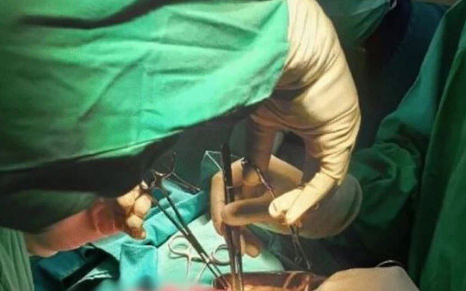Bé trai 3 tuổi nôn ra giun, khi phẫu thuật bác sĩ phát hiện điều đáng sợ hơn