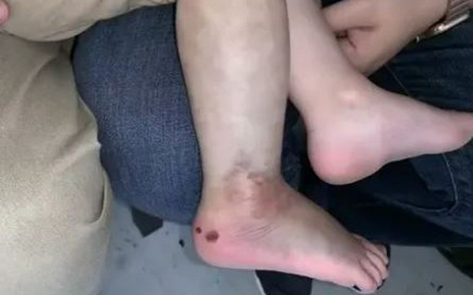 Nghe cháu trai 3 tuổi khóc thét, ông nội chạy ra thì chứng kiến cảnh "đáng sợ"
