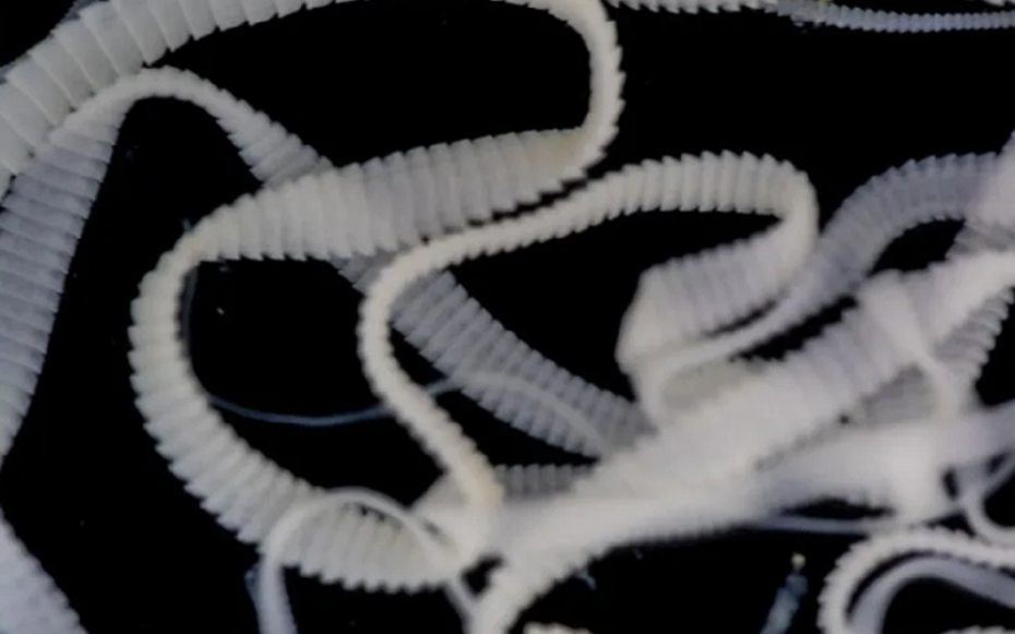 Đi du lịch về, cô gái phát hiện 38 nang sán "đáng sợ" trong não