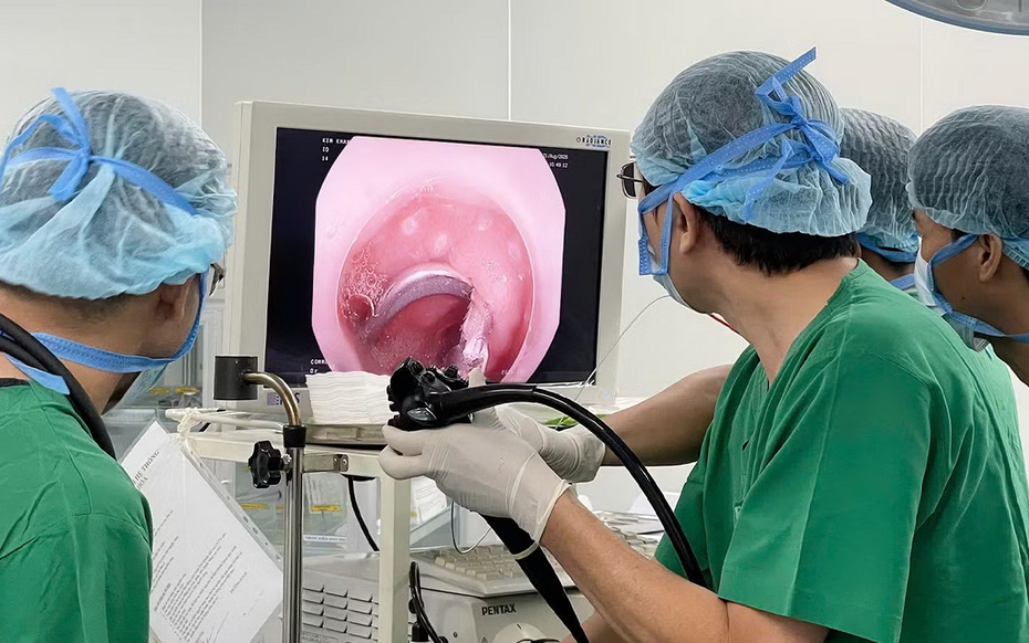 Bé 3 tuổi đau bụng, bác sĩ phát hiện "vật lạ" mắc trong tá tràng