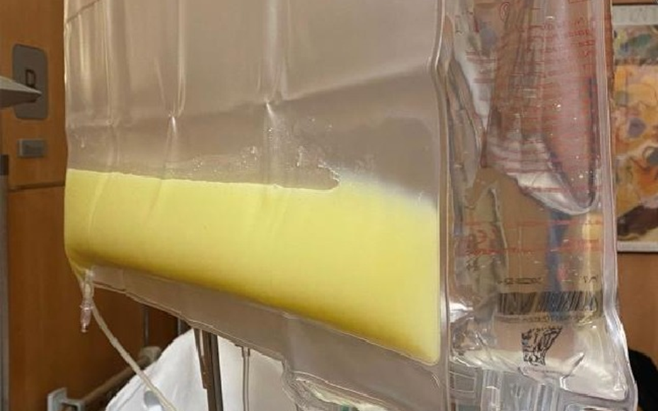 Người đàn ông 36 tuổi "máu trắng đục như mỡ lợn" vì thường xuyên ăn món ai cũng thích
