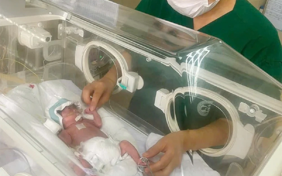 Kỳ tích cứu sống em bé sinh non 25 tuần, nặng chưa đầy 700 gram