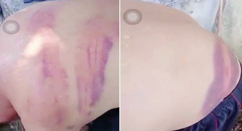 Vụ người đàn ông mù lòa có nhiều vết bầm tím trên cơ thể: Bất ngờ danh tính người phụ nữ