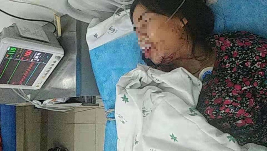 Sự thật bất ngờ về thông tin cô dâu Việt bị chồng bạo hành đến nhập viện