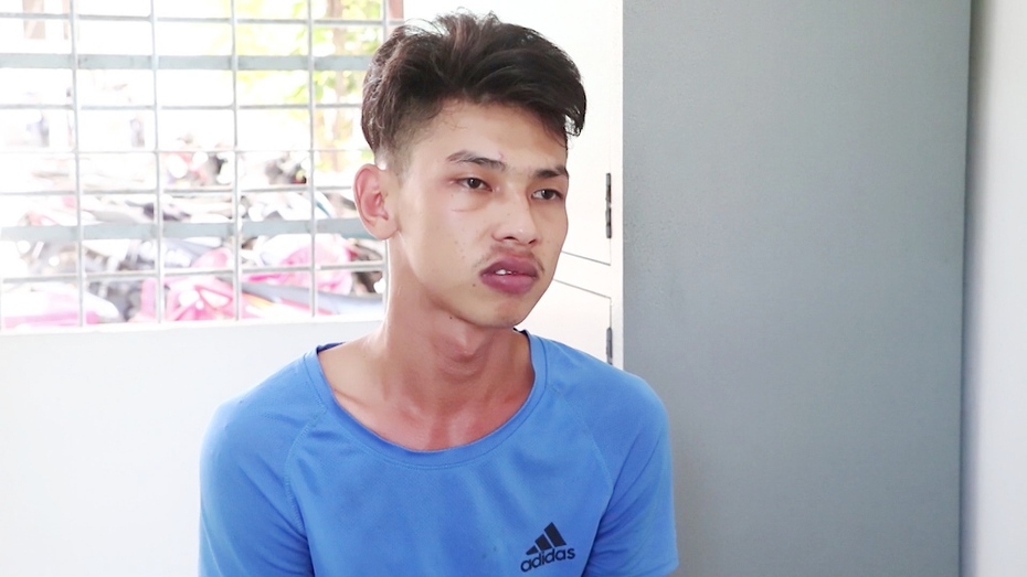 Tạm giữ hình sự thanh niên dùng dao chém lìa tay đối phương