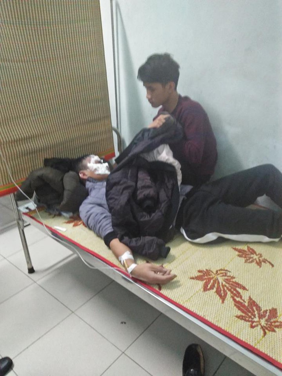 Dùng bật lửa đốt xăng, nam sinh 16 tuổi bị bỏng 2 mắt