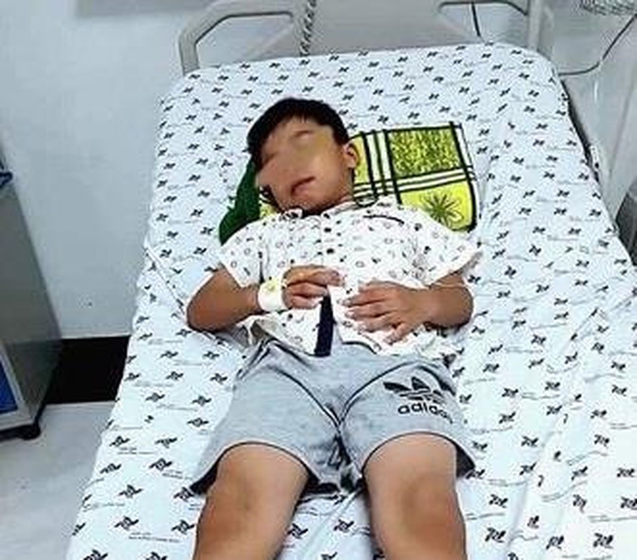 Ngậm kẹo ngủ quên, bé trai 7 tuổi nuốt que nhựa dài 7,5cm vào bụng