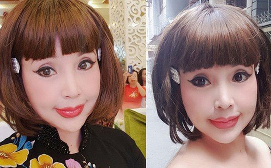 Những nhan sắc lạm dụng dao kéo gây tiếc nuối nhất Vbiz