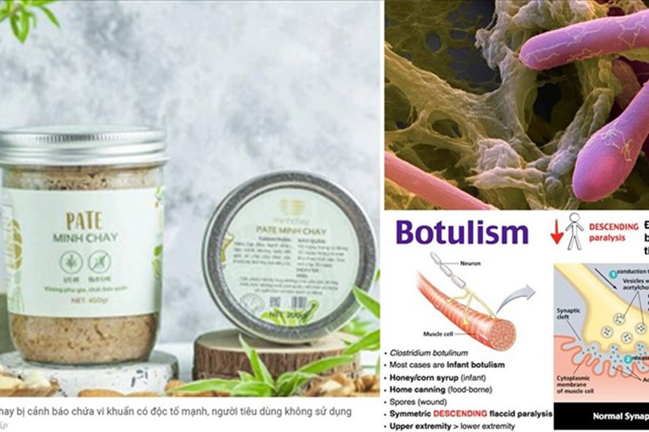 Vi khuẩn Clostridium botulinum được tìm thấy trong Pate Minh Chay chứa độc tố gây chết người