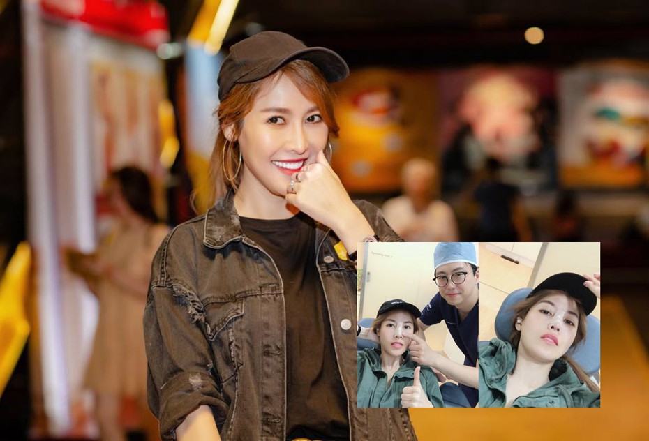 Quế Vân “dao kéo” mũi lần thứ 6: “Nếu chưa ưng ý tôi vẫn tiếp tục thẩm mỹ”