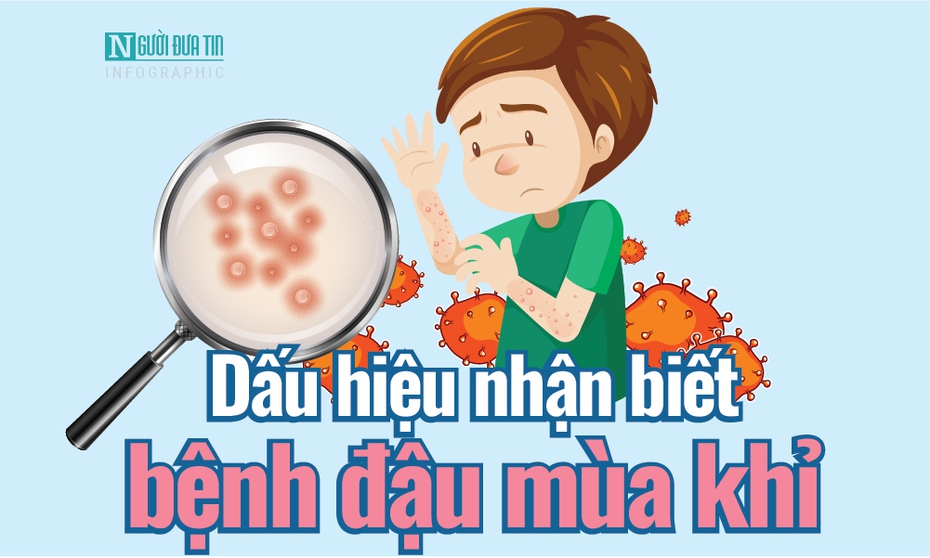 Info: Dấu hiệu nhận biết bệnh đậu mùa khỉ