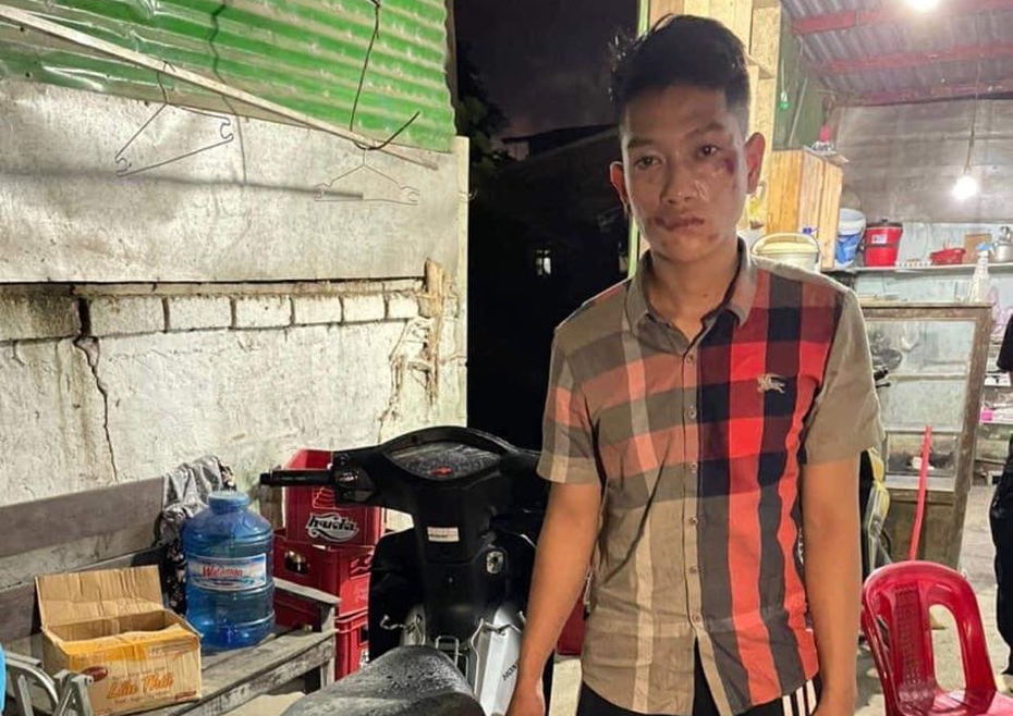 Thừa Thiên-Huế: Làm rõ vụ gây tai nạn rồi bỏ trốn