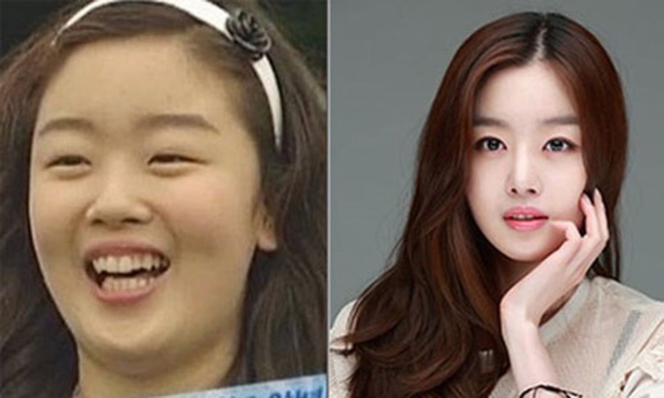 Chồng tâm lý vay tiền cho vợ đi làm đẹp khiến dân mạng xuýt xoa