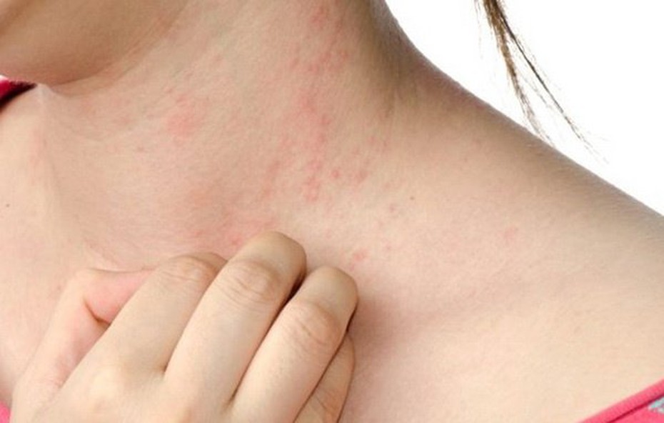 Cô gái 32 tuổi bị ung thư gan, hãi hùng khi bác sĩ chỉ ra 4 dấu hiệu này